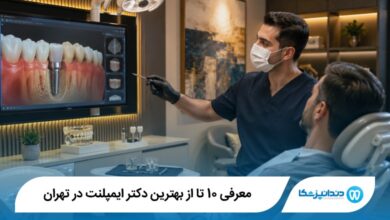 بهترین دکتر ایمپلنت در تهران