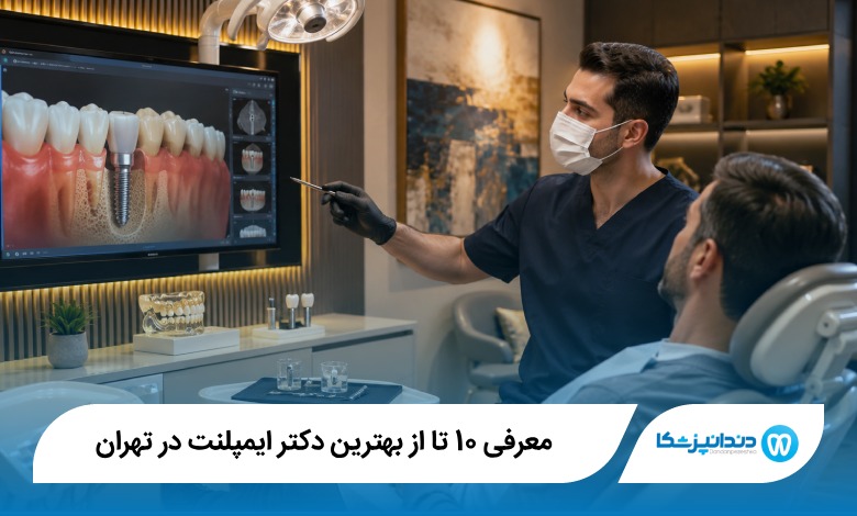 بهترین دکتر ایمپلنت در تهران