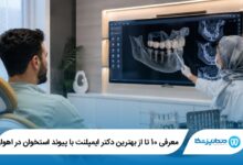 بهترین دکتر ایمپلنت با پیوند استخوان در اهواز