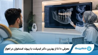 بهترین دکتر ایمپلنت با پیوند استخوان در اهواز