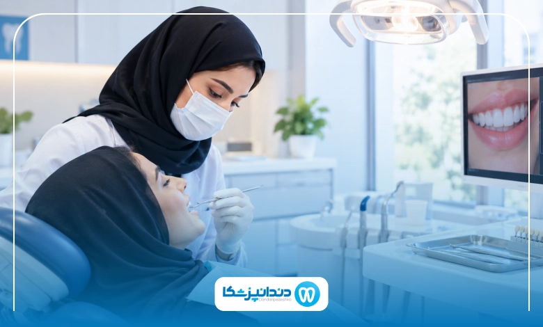 فرق لمینت سرامیکی و کامپوزیتی چیست؟