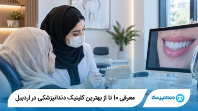بهترین دکتر لمینت در اردبیل