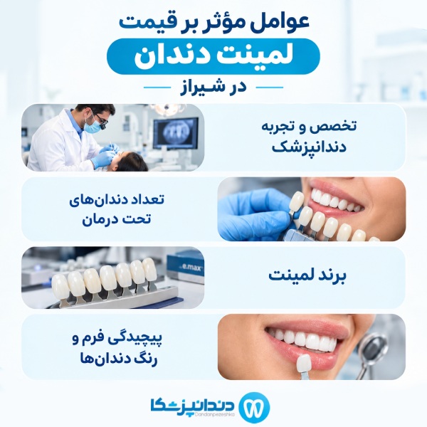 عوامل موثر بر قیمت لمینت دندان در شیراز