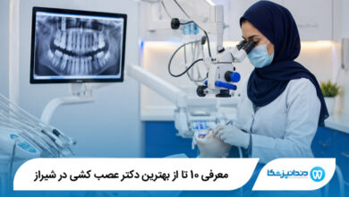 بهترین دکتر عصب کشی در شیراز