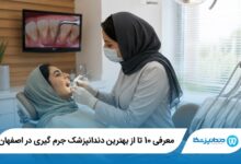 بهترین دندانپزشک جرم گیری در اصفهان