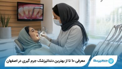 بهترین دندانپزشک جرم گیری در اصفهان