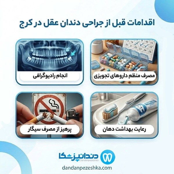 اقدامات قبل از جراحی دندان عقل در کرج