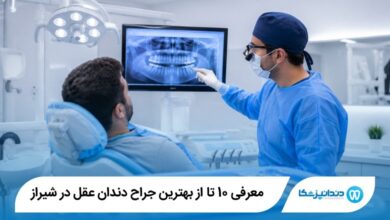 بهترین جراح دندان عقل در شیراز
