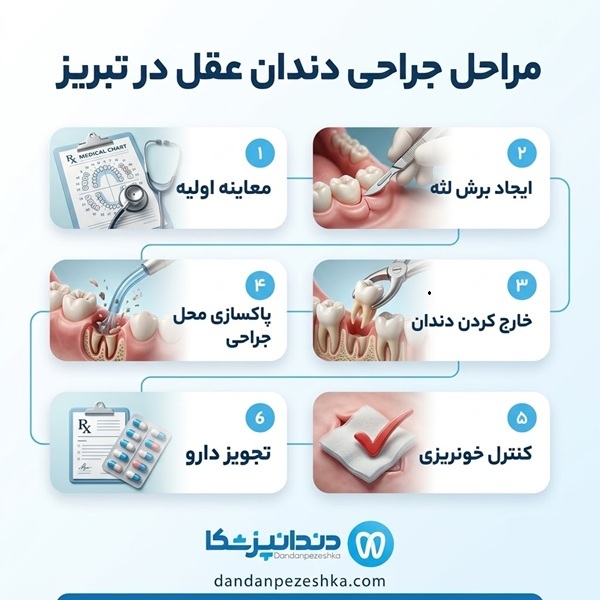 مراحل جراحی دندان عقل در تبریز