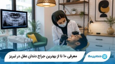 بهترین جراح دندان عقل در تبریز