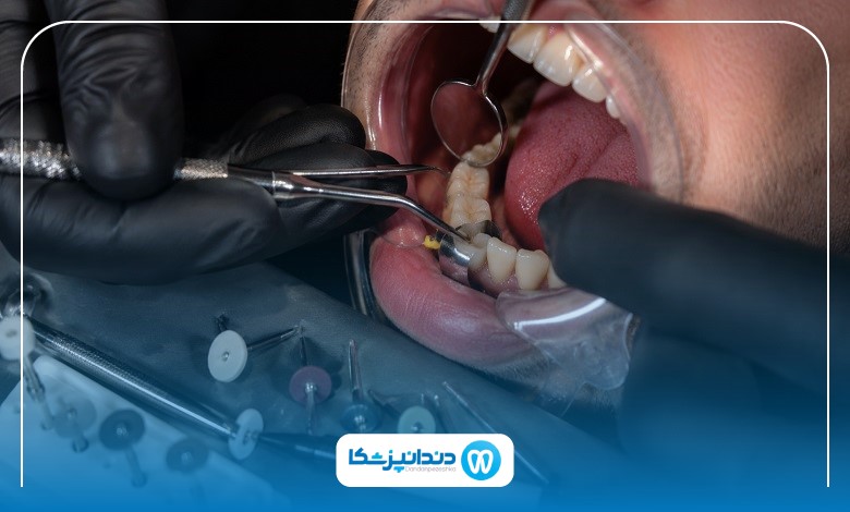 تفاوت دندانپزشک عمومی و متخصص ترمیمی در کرمان