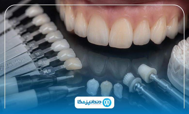 مشخصات بهترین دکتر کامپوزیت در بوشهر