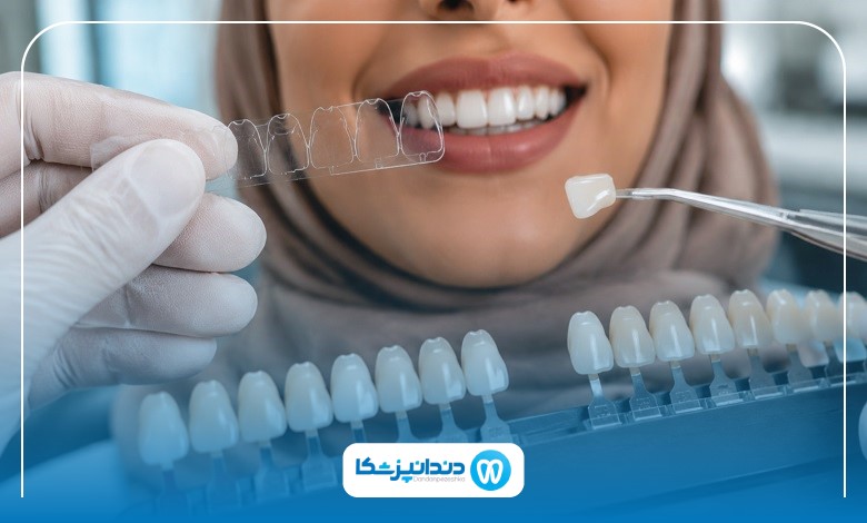 مراقبت‌های مهم بعد مراجعه به بهترین دندانپزشک زیبایی در کرمان