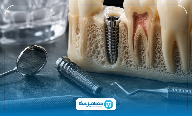 چرا انتخاب بهترین جراح دندانپزشک در بوشهر اهمیت دارد؟