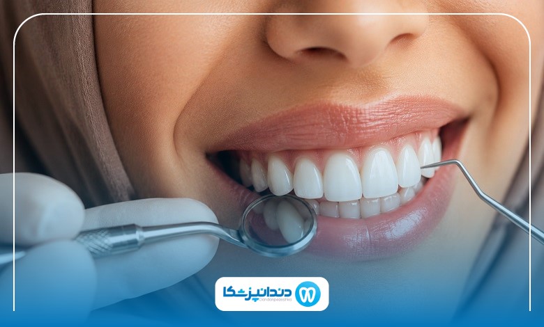 نکات مراقبت از دندان پس از مراجعه به دندانپزشک