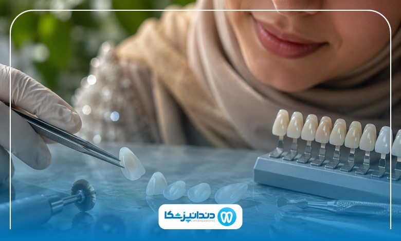 مراقبت‌های لازم بعد از لمینت دندان در کرمان