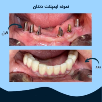 دکتر نادر نورزاده افشار