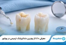 معرفی 10 تا از بهترین دندانپزشک ترمیمی در بوشهر 【سال 1405】⭐