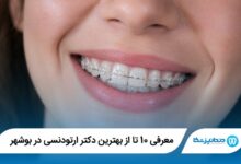 معرفی 10 تا از بهترین دکتر ارتودنسی در بوشهر