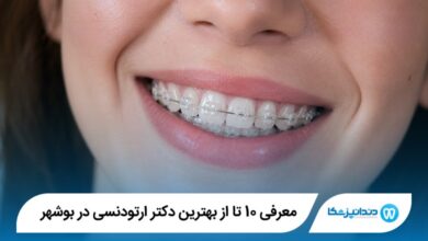 معرفی 10 تا از بهترین دکتر ارتودنسی در بوشهر