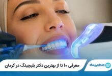 معرفی 10 تا از بهترین دکتر بلیچینگ در کرمان 【سال1405】⭐