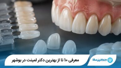 معرفی 10 تا از بهترین دکتر لمینت در بوشهر 【سال1405】⭐