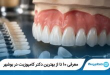معرفی 10 تا از بهترین دکتر کامپوزیت در بوشهر 【سال1405】⭐