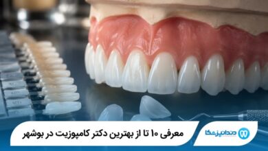 معرفی 10 تا از بهترین دکتر کامپوزیت در بوشهر 【سال1405】⭐