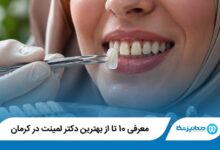 معرفی 10 تا از بهترین دکتر لمینت در کرمان 【سال1405】⭐