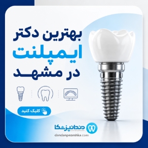 بهترین دکتر ایمپلنت در مشهد