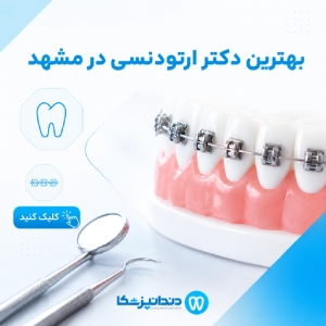 بهترین دکتر ارتودنسی در مشهد