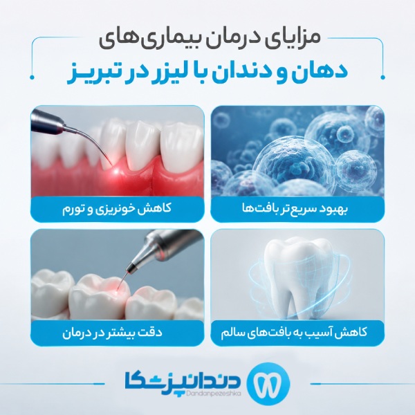 مزایای درمان بیماری های دهان و دندان با لیزر در تبریز
