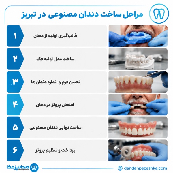 مراحل ساخت دندان مصنوعی در تبریز