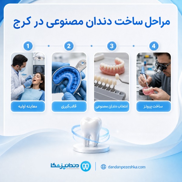 مراحل ساخت دندان مصنوعی در کرج