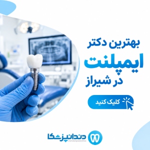 بهترین دکتر ایمپلنت در شیراز