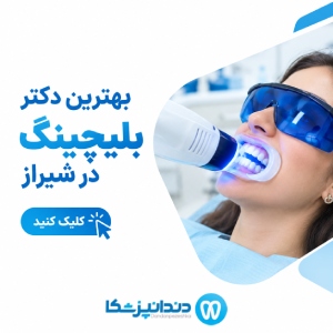 بهترین دکتر بلیچینگ در شیراز