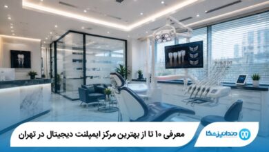 بهترین مرکز ایمپلنت دیجیتال در تهران