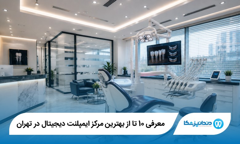 بهترین مرکز ایمپلنت دیجیتال در تهران