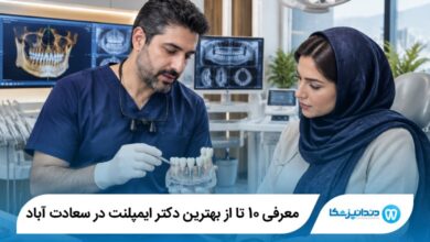 بهترین دکتر ایمپلنت در سعادت آباد