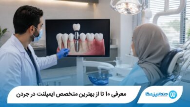 بهترین متخصص ایمپلنت در جردن