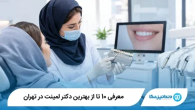 بهترین دکتر لمینت در تهران