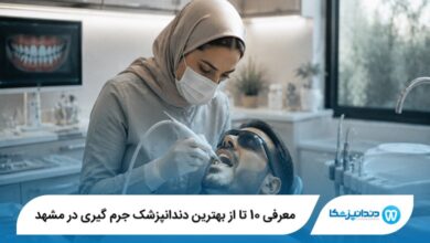 معرفی 10 تا از بهترین دندانپزشک جرم گیری در مشهد
