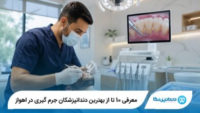 معرفی 10 تا از بهترین دندانپزشکان جرم گیری در اهواز