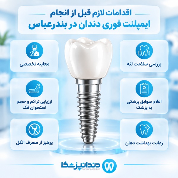 اقدامات لازم قبل از انجام ایمپلنت فوری دندان در بندرعباس
