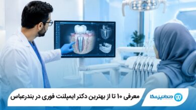 بهترین دکتر ایمپلنت فوری در بندرعباس