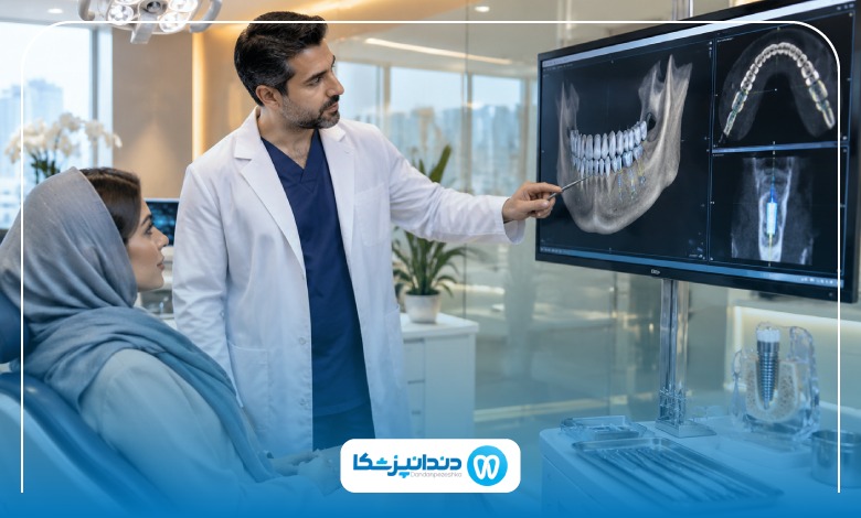 ایمپلنت فوری با لیزر چیست و چه مزایایی دارد؟