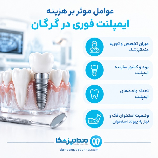 عوامل موثر بر هزینه ایمپلنت فوری در گرگان 