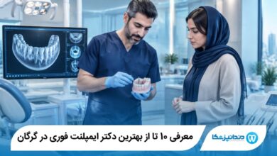بهترین دکتر ایمپلنت فوری در گرگان