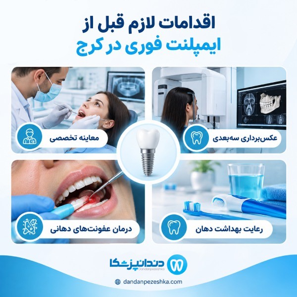 اقدامات لازم قبل از ایمپلنت فوری در کرج
