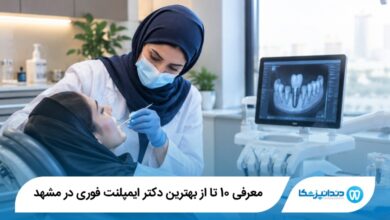 بهترین دکتر ایمپلنت فوری در مشهد